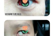 解梦双眼出血预兆 解梦双眼出血预兆