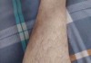 小腿有毛旋，如何解读？
