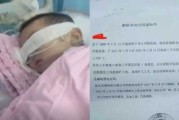 家人得脑瘤犯了什么