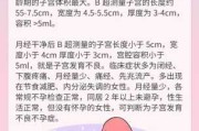 子女宫解梦真的靠谱吗？