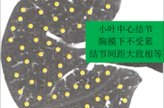 小叶海棠，中的贵客与象征