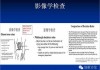 左膝盖疼痛，揭示潜在健康隐患