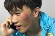 解的脸被划伤出血，解读内心与外表的双重伤痕