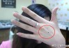 背上长痣算命口诀，解读与 significance