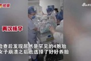 剖腹产不给算命?这些真相你绝对想不到! 剖腹产不给算命?这些真相你绝对想不到!