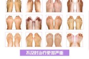 揭秘脚趾头缝隙大的奥秘，算命中的神秘信号