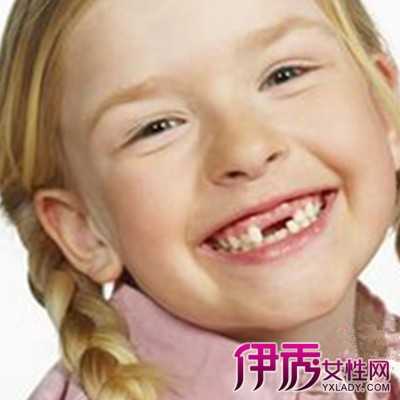 解梦牙掉了2颗，解析梦境中的牙齿丢失象征意义,象征,挑战,解梦,第1张