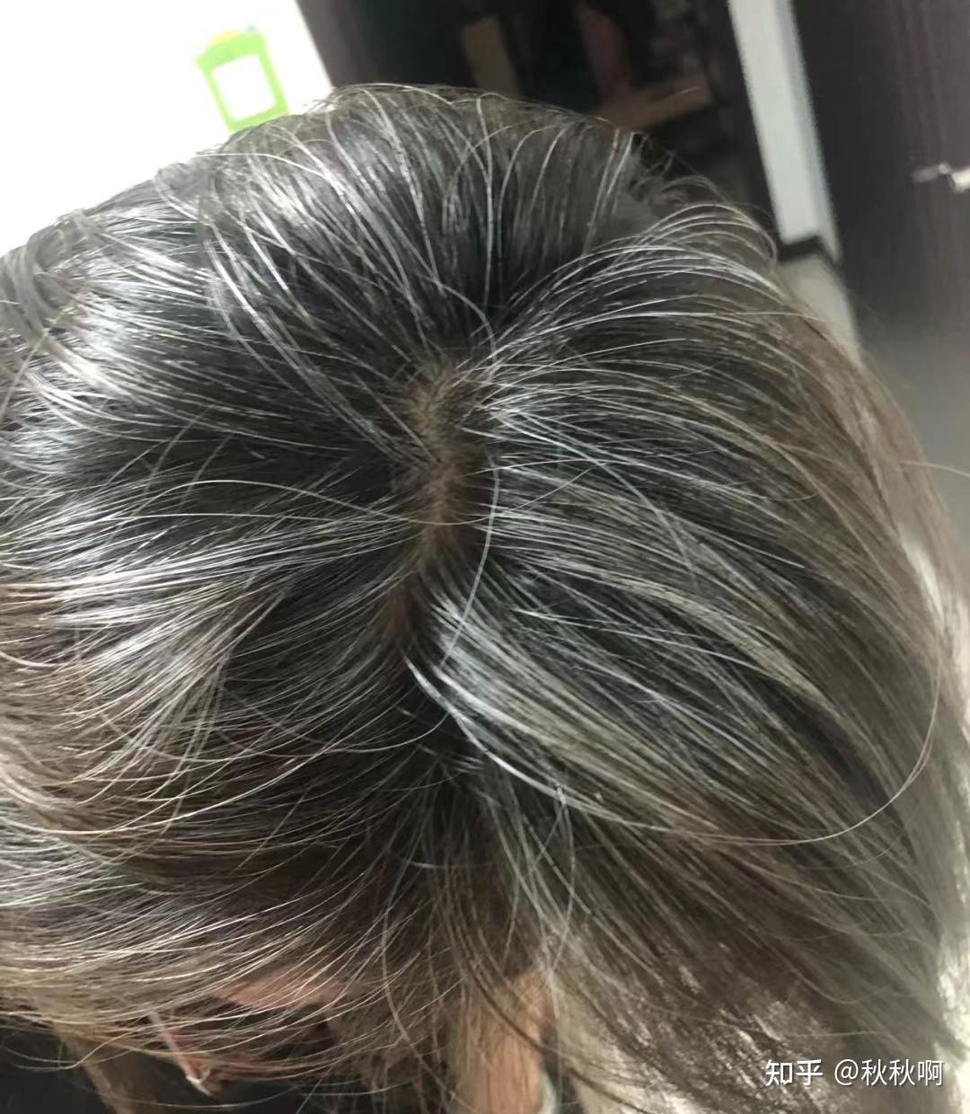 白发占卜，解读命运与健康的关键,象征,命运,自我,第1张