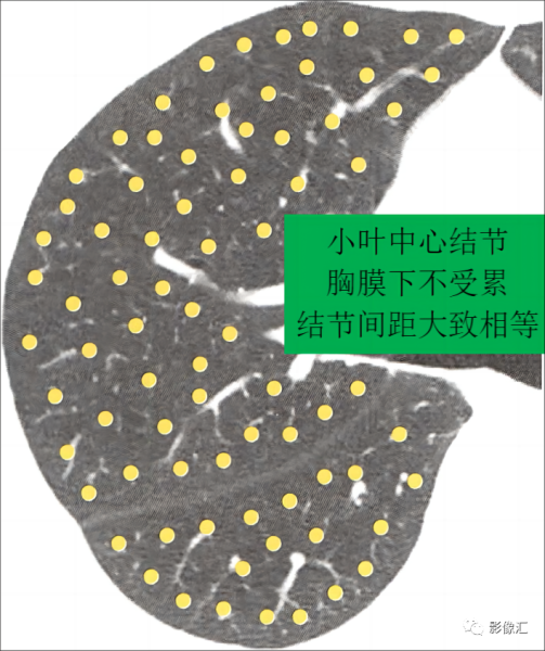 小叶海棠，中的贵客与象征,象征,事业,风水布局,第1张