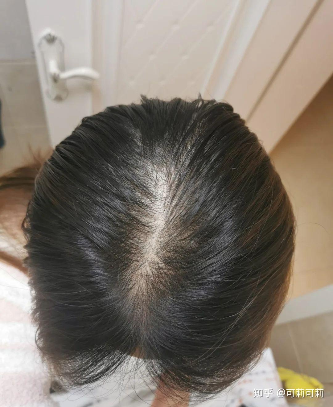 头顶上空一只老鹰,预兆与解梦的深层解析,象征,挑战,解梦,第1张 头顶上空一只老鹰,预兆与解梦的深层解析,象征,挑战,解梦,第1张