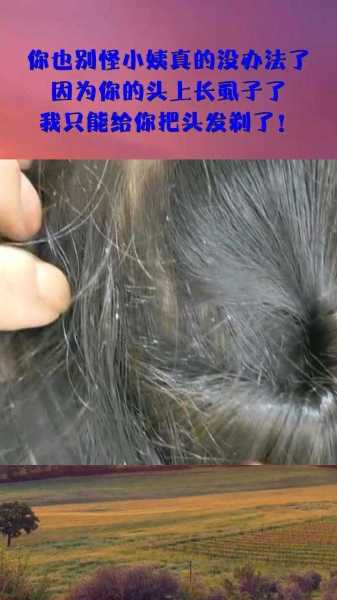 解梦,头长虱子预示着什么?揭秘梦境中的寓意与启示,象征,挑战,解梦,第1张 解梦,头长虱子预示着什么?揭秘梦境中的寓意与启示,象征,挑战,解梦,第1张