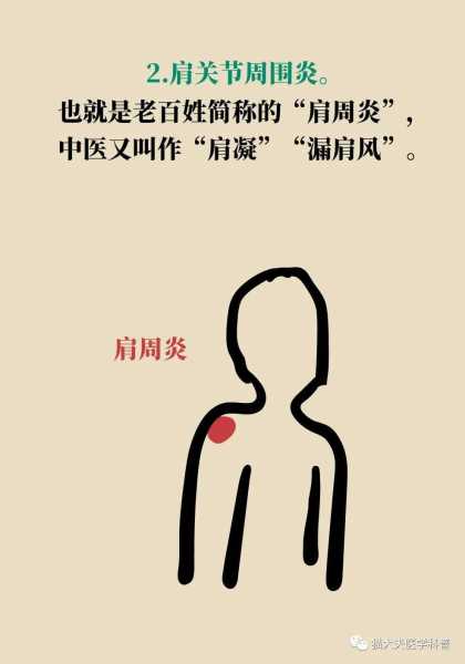 左肩膀酸疼痛揭秘,背后的及化解之道,气场,风水布局,风水,第1张 左肩膀酸疼痛揭秘,背后的及化解之道,气场,风水布局,风水,第1张