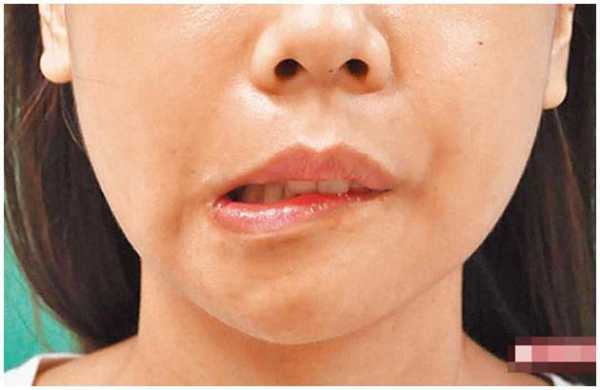 嘴歪的解读，揭秘嘴角歪斜背后的运势秘密,象征,事业,希望,第1张