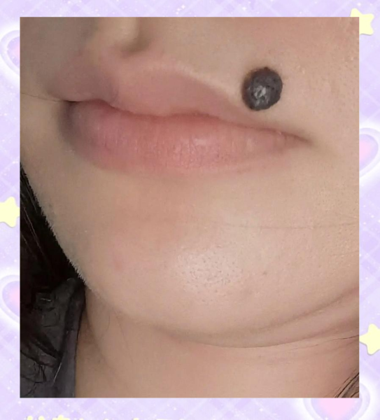 嘴角丫上痣的解析,揭秘嘴角痣的神秘寓意与影响,象征,事业,挑战,第1张 嘴角丫上痣的解析,揭秘嘴角痣的神秘寓意与影响,象征,事业,挑战,第1张