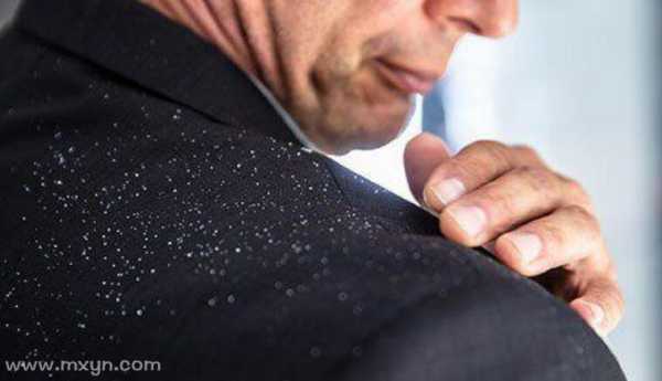 解梦,头上有头皮屑究竟预示着什么?,象征,挑战,自我,第1张 解梦,头上有头皮屑究竟预示着什么?,象征,挑战,自我,第1张