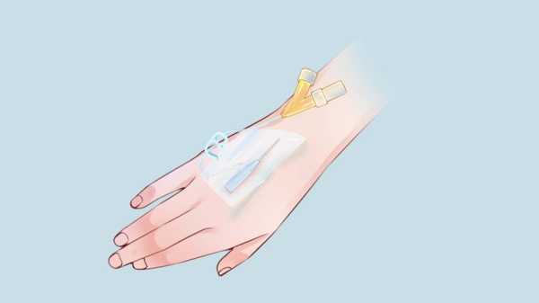 揭秘梦境,梦见扎滞留针的寓意与周公解梦解析,挑战,希望,解梦,第1张 揭秘梦境,梦见扎滞留针的寓意与周公解梦解析,挑战,希望,解梦,第1张