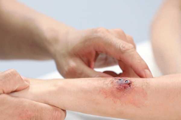 梦见咬别人胳膊的预兆与解梦解析,希望,解梦,第1张