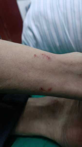 梦见花蛇咬人,周公解梦揭示的花蛇咬人预示,象征,挑战,解梦,第1张 梦见花蛇咬人,周公解梦揭示的花蛇咬人预示,象征,挑战,解梦,第1张