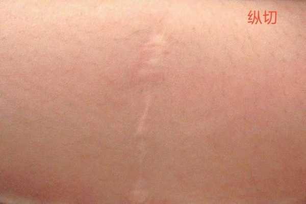 揭秘脑后有竖疤的之谜,究竟隐藏着怎样的运势暗示?,象征,命运,事业,第1张 揭秘脑后有竖疤的之谜,究竟隐藏着怎样的运势暗示?,象征,命运,事业,第1张